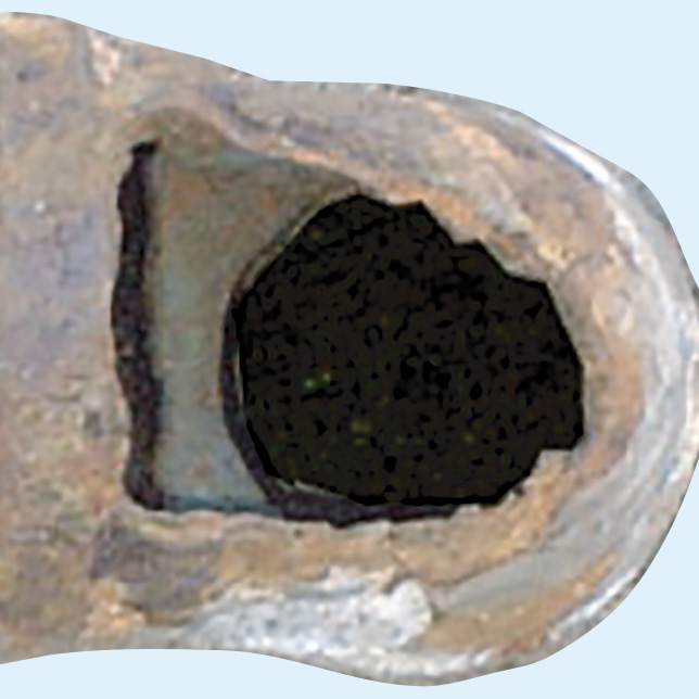 P・C・G FRPサポーター工法 施工写真03